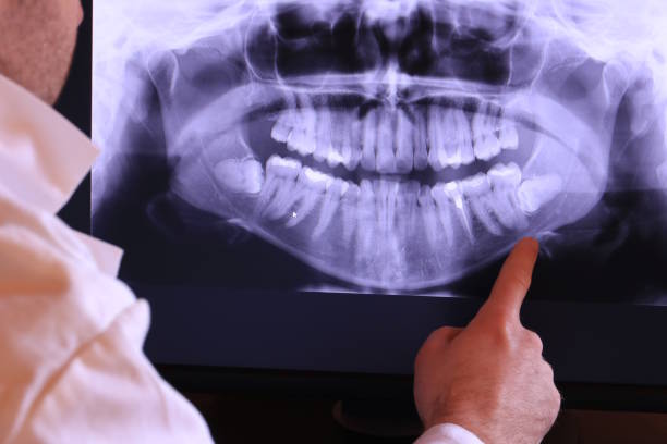 Best Pediatric Emergency Dentist in New Square, NY