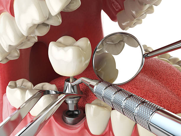 Best Emergency Denture Repair in New Square, NY